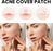 Acne Cover Patch (72pc)